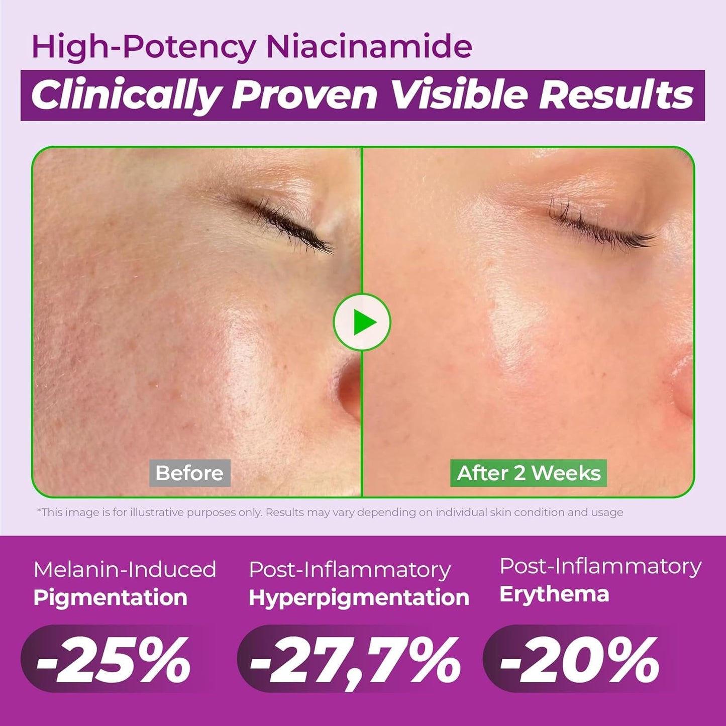 Niacinamide Dark Spot Correcting Serum