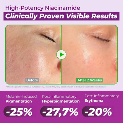 Niacinamide Dark Spot Correcting Serum